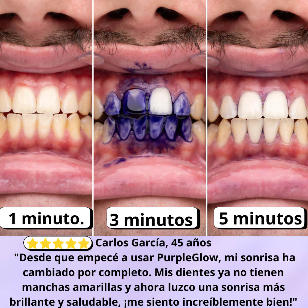 PurpleGlow: Belleza que Comienza con Tu Sonrisa.